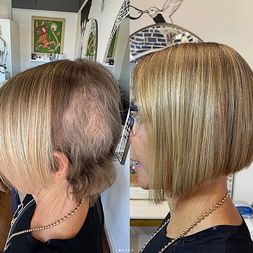 Hair Breakage Before & After - Great Lengths Australia & New Zealand