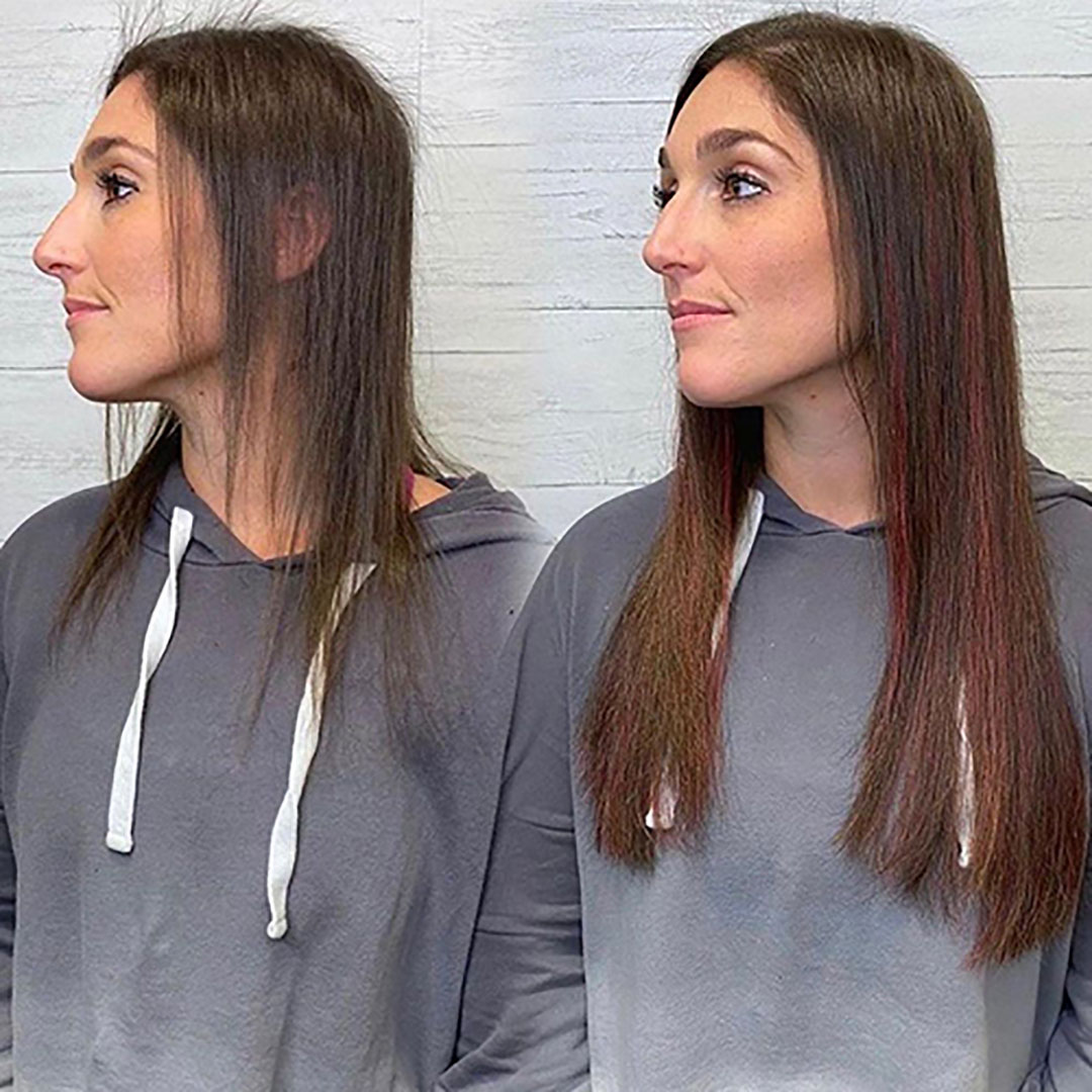 Thinning Hair Before & After - Great Lengths Australia & New Zealand