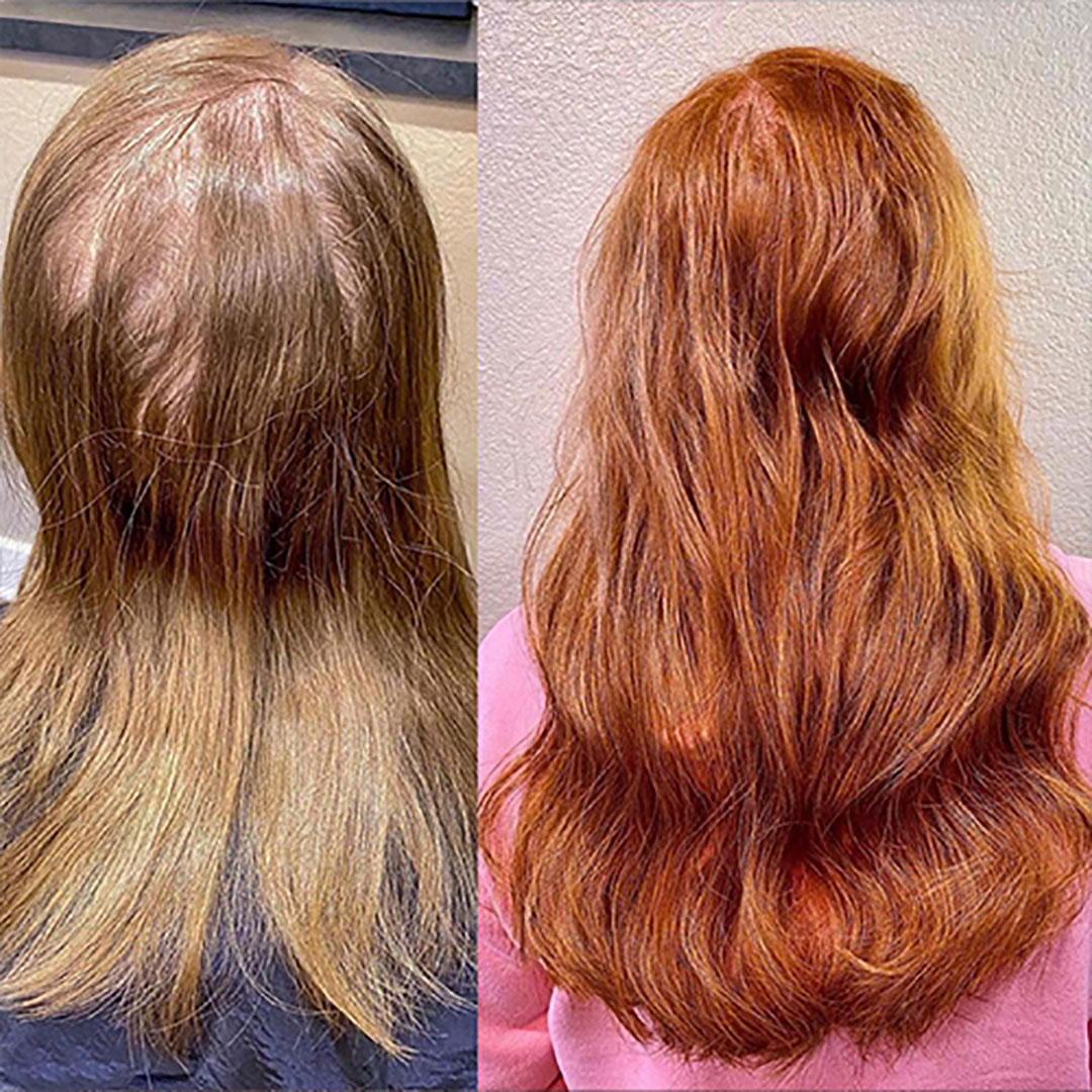 Thinning Hair Before & After - Great Lengths Australia & New Zealand