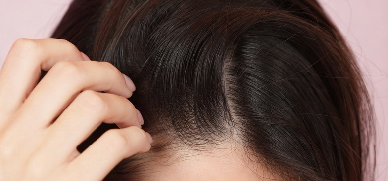 Sensitive scalp hair care - Great Lengths guide